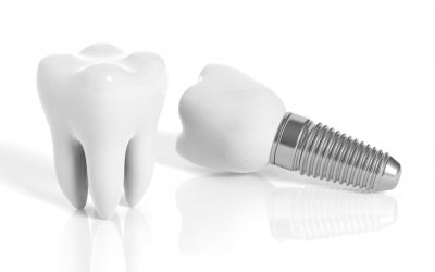 Czy implant boli?