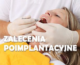 Zalecenia po zabiegu implantacji