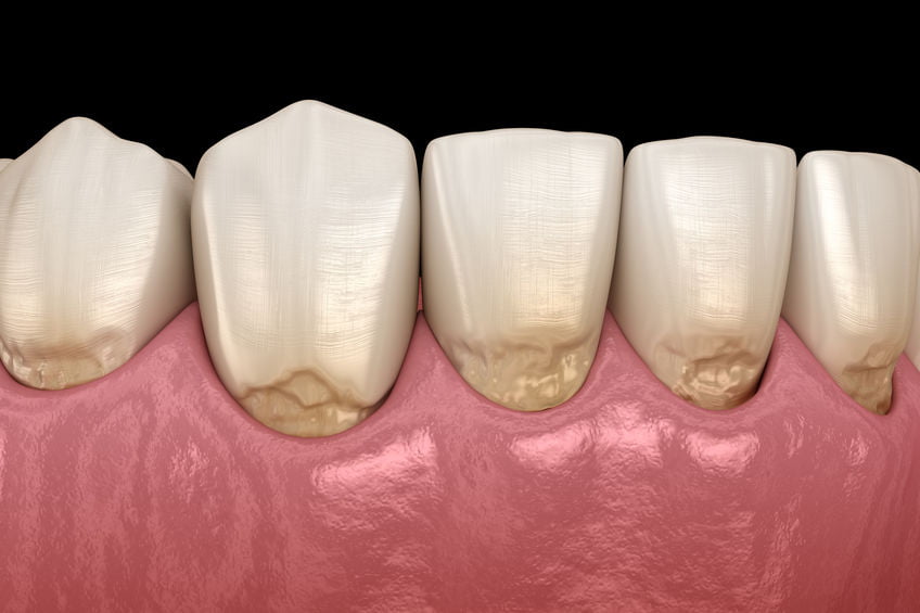 implant-centrum-stomatologiczne-demed